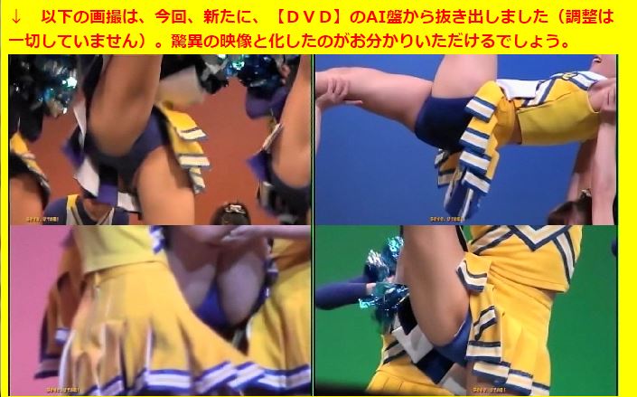 AI4592「キューティーチアガール発熱カルテ（25）」