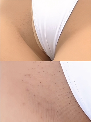 レースクイーンの超ハイレグ RQ406