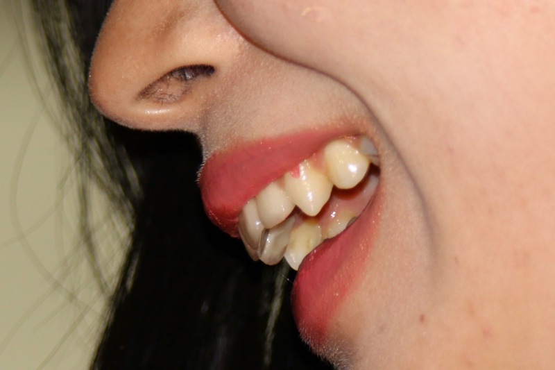 キャンギャル5