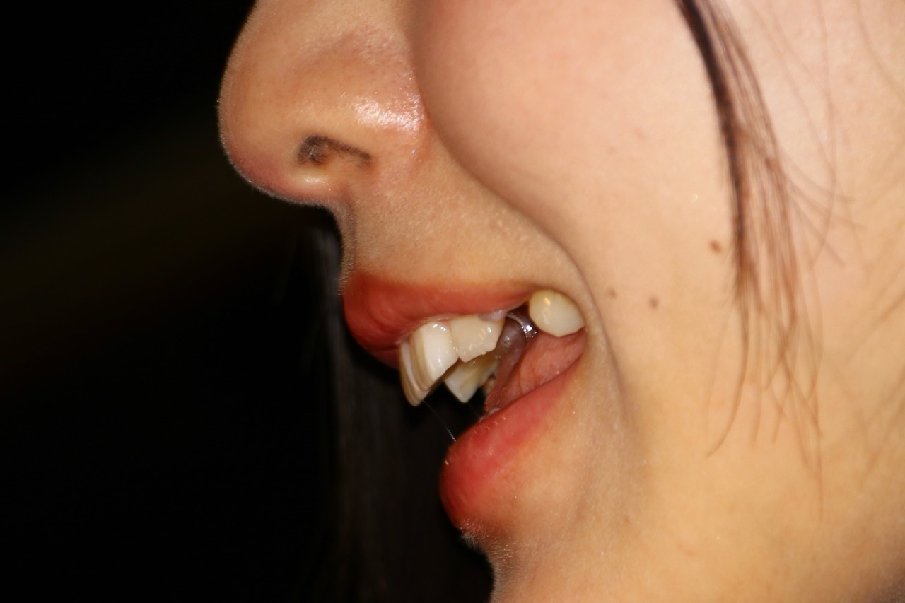 PALPIS キャンギャル8 g79.zip 94363