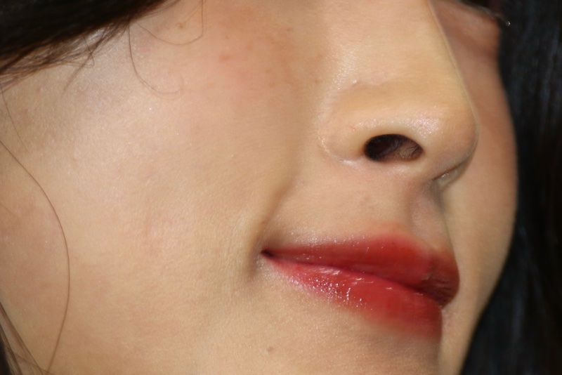 キャンギャル10