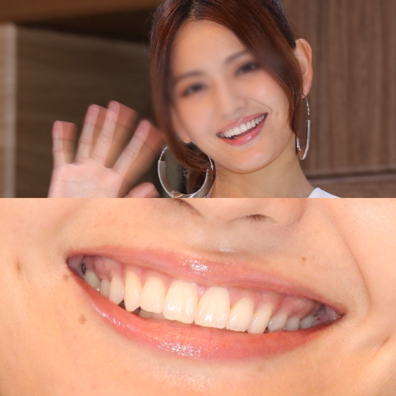 キャンギャル14