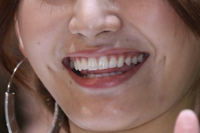 キャンギャル14