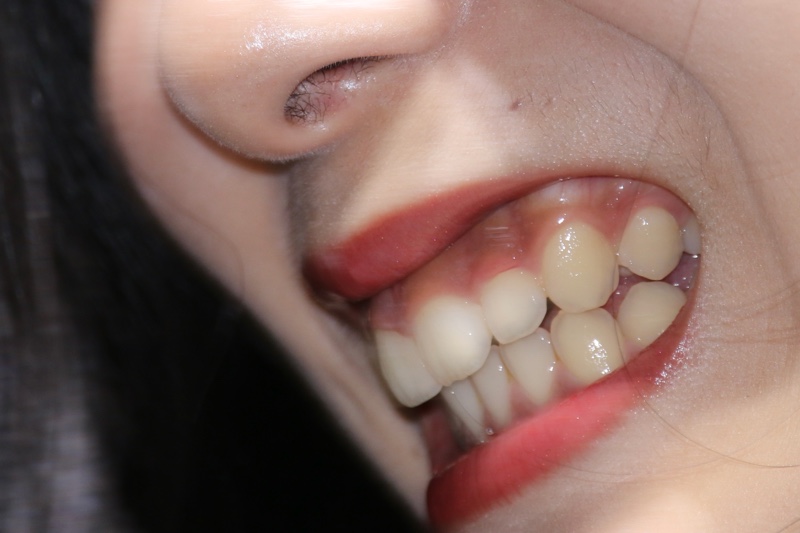 キャンギャル17