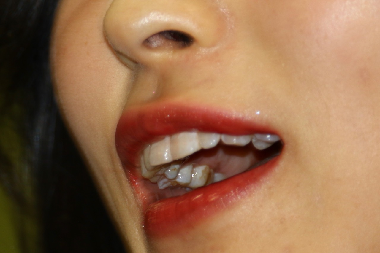 キャンギャル18