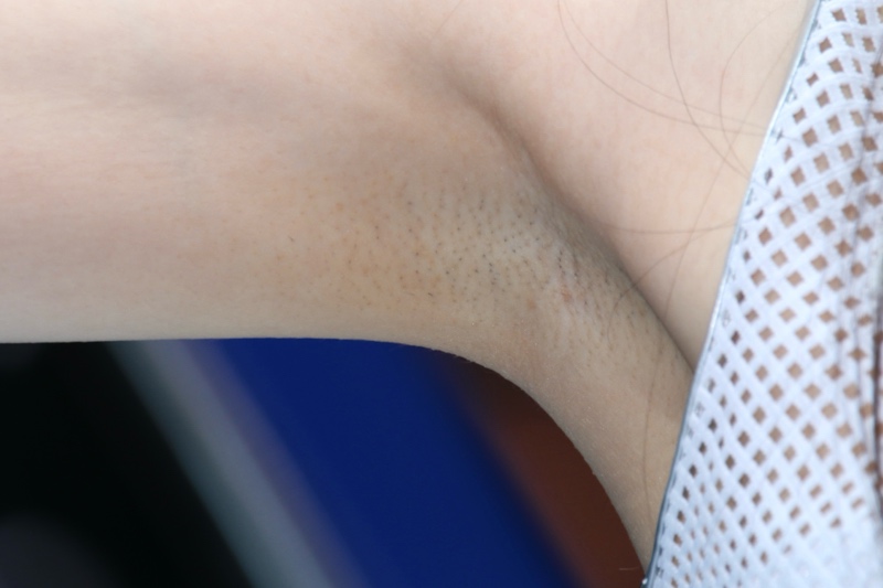 キャンギャル20