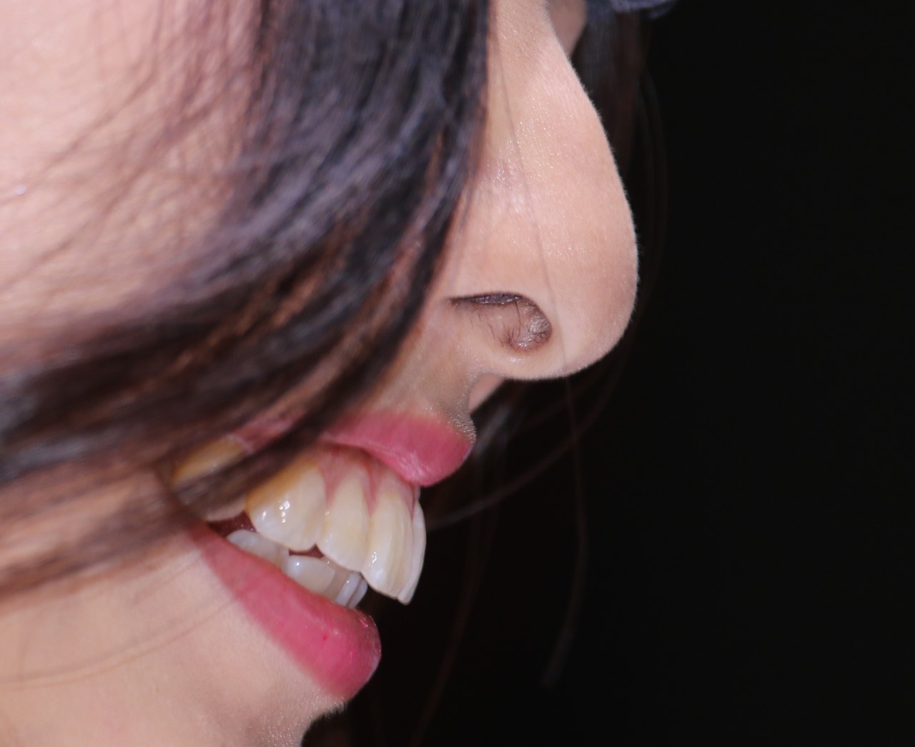 キャンギャル31