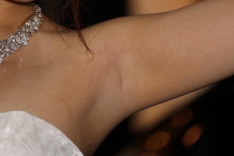 キャンギャル35