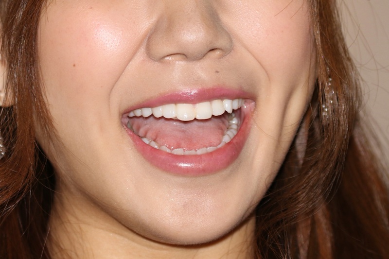 キャンギャル35