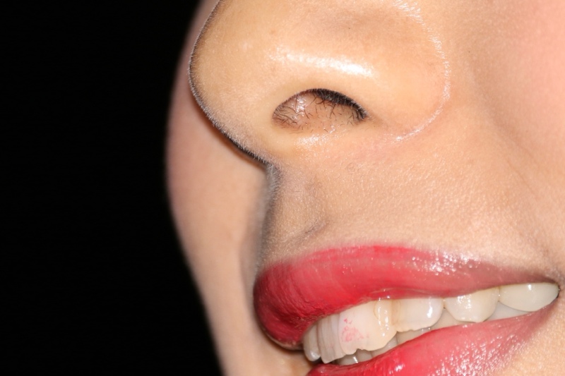 キャンギャル36