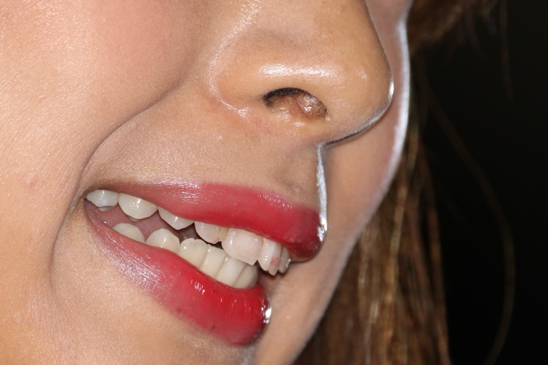 キャンギャル36