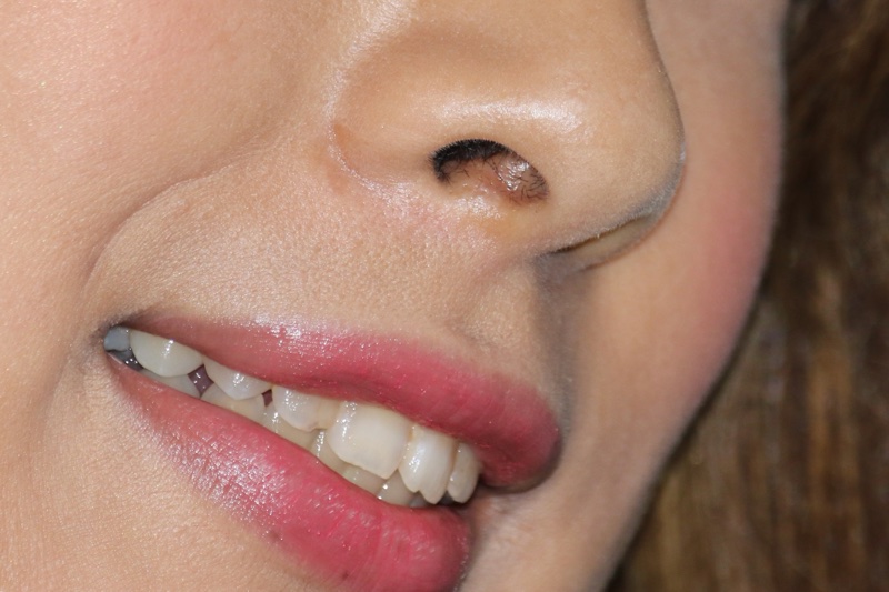 Palpis PPV 94779 キャンギャル43