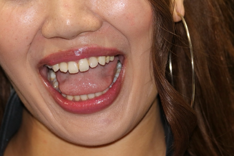 キャンギャル103