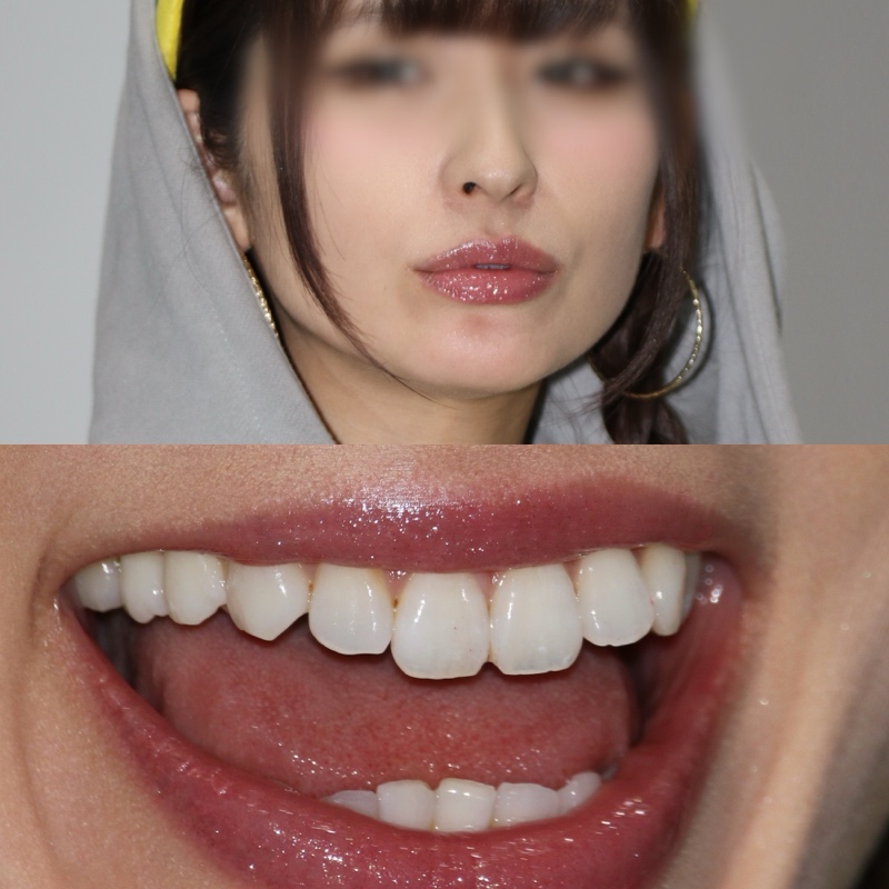 キャンギャル290