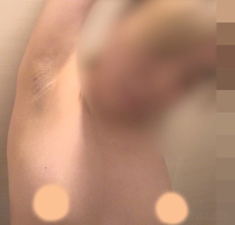 Karte.13 金髪で垢抜けを狙うJKの着替え盗撮 #これがこう