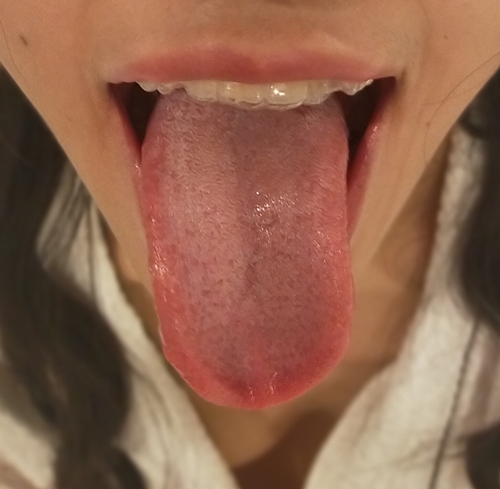 ツバベロマニア